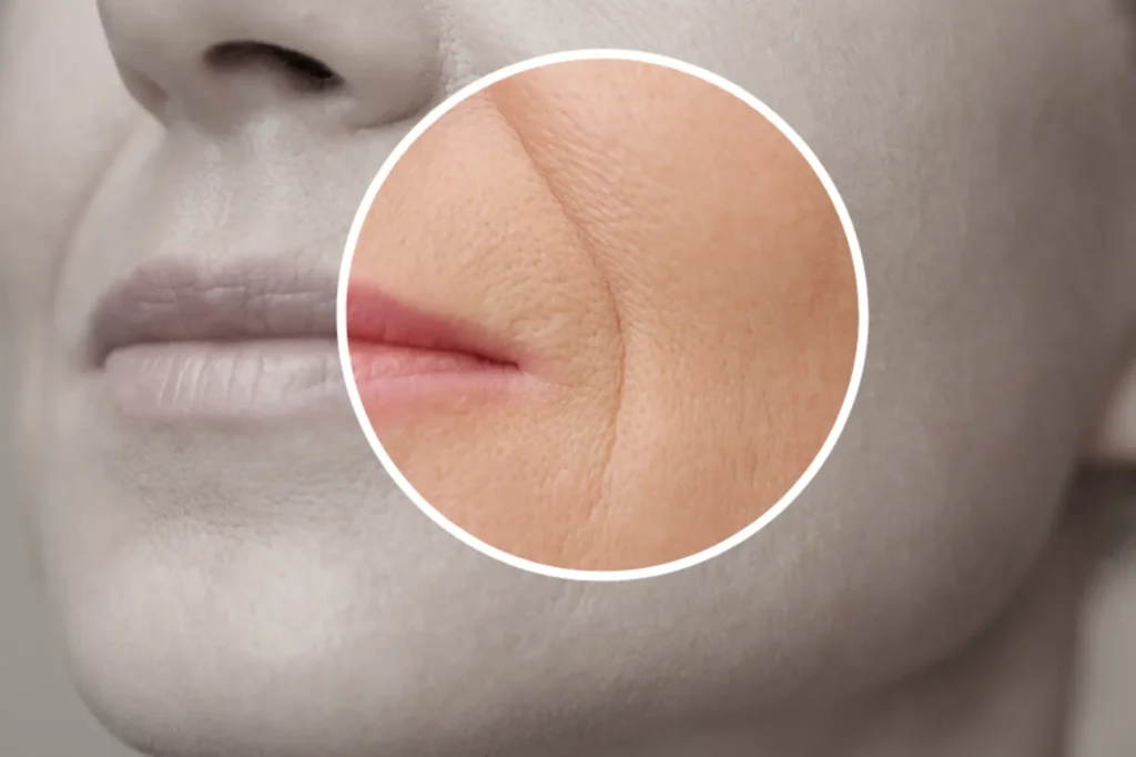 anti aging treatment lahore
