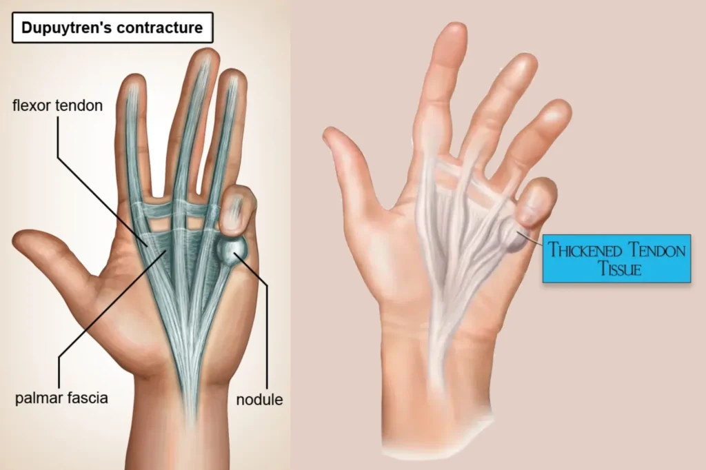 hand specialist lahore