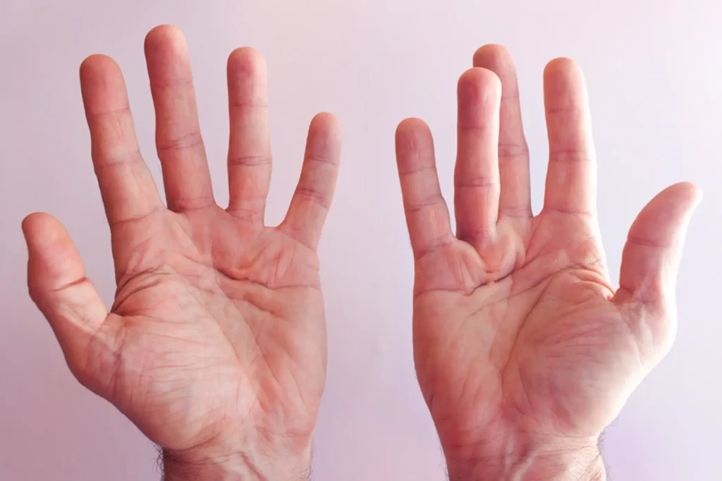 hand surgery lahore