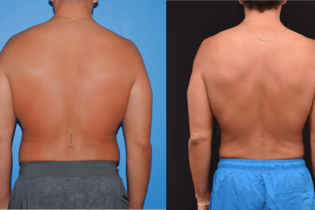 body contouring lahore