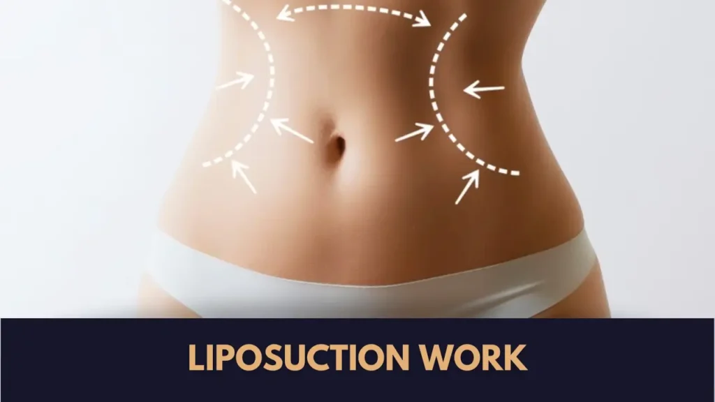 how does liposuction work